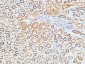 TNF-R1 Polyclonal Antibody